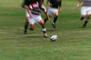 フィット感を追求したマウスガード